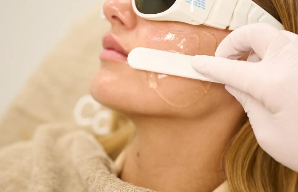 Epilation du visage :